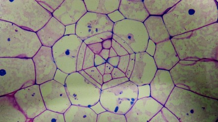 Azolla root cross-section, showing the tetrahedral apical meristem in the centre