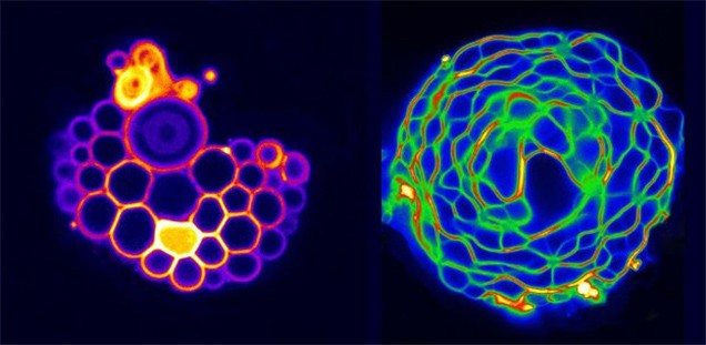 Designing new channel inhibitors for treating chronic pain | ANU ...