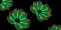 Toxoplasma gondii Toxoplasma gondii