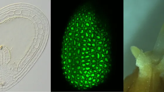 Three images showing microscopic views: a cross-section of a plant with cellular detail, an illuminated close-up of green plant cells in high detail, and a zoom on a plant structure resembling a stem tip.