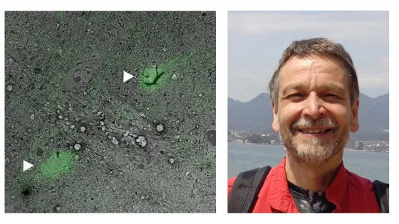 Microscopic image of cells marked with bright green dye on the left and a smiling man in a red jacket with a coastal landscape behind him on the right.