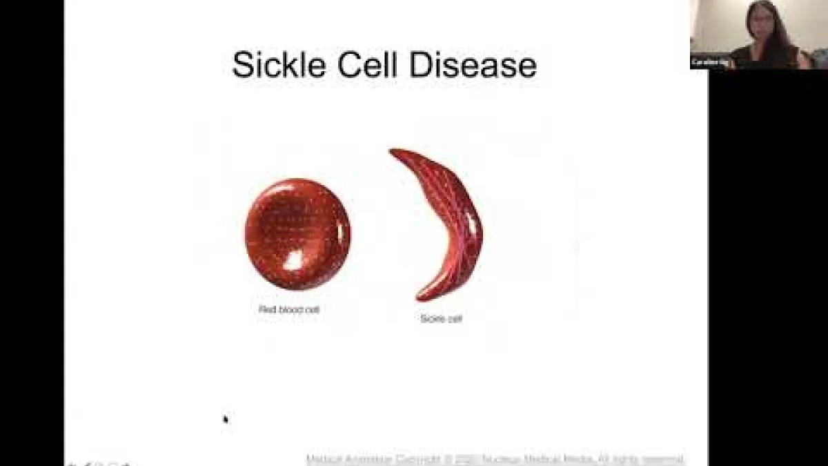 Preview image for the video "Recorded seminar - Caroline Ng".