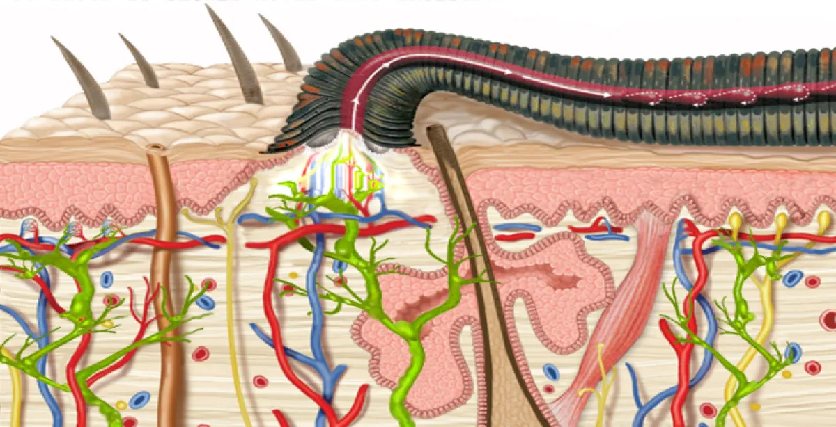 Medicinal leech