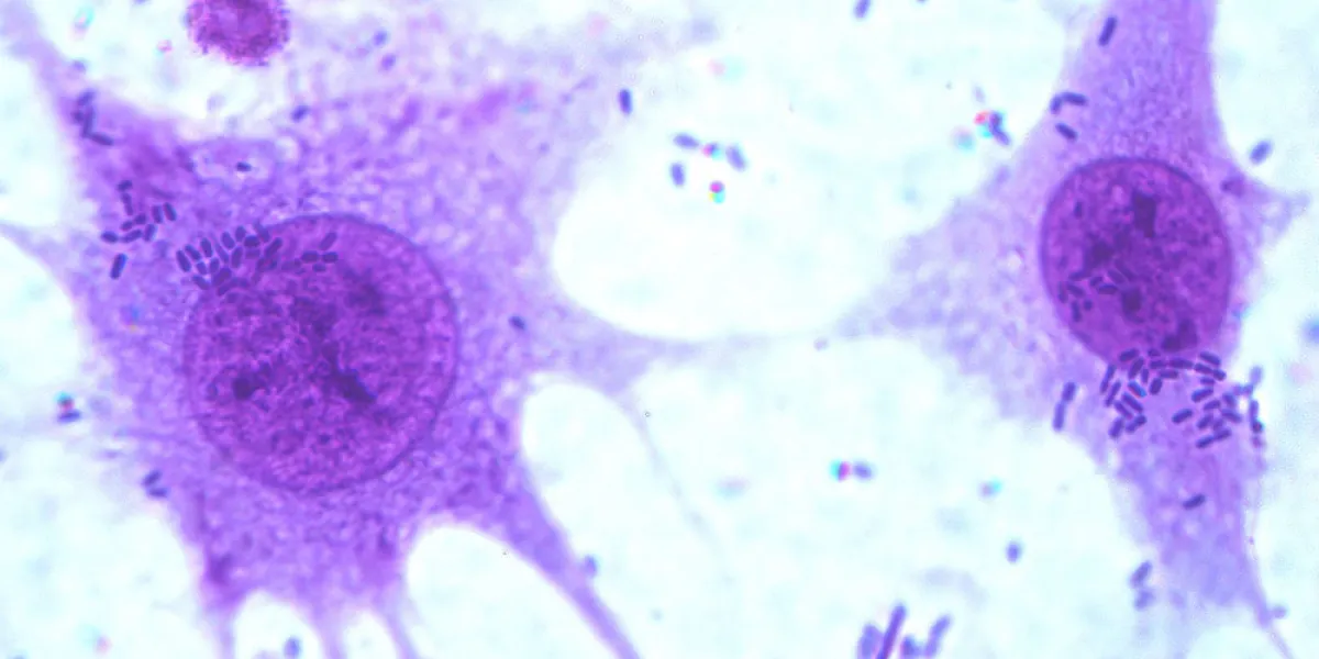Microscopic image of two cells stained purple, showing detailed internal structures and surrounding smaller particles.