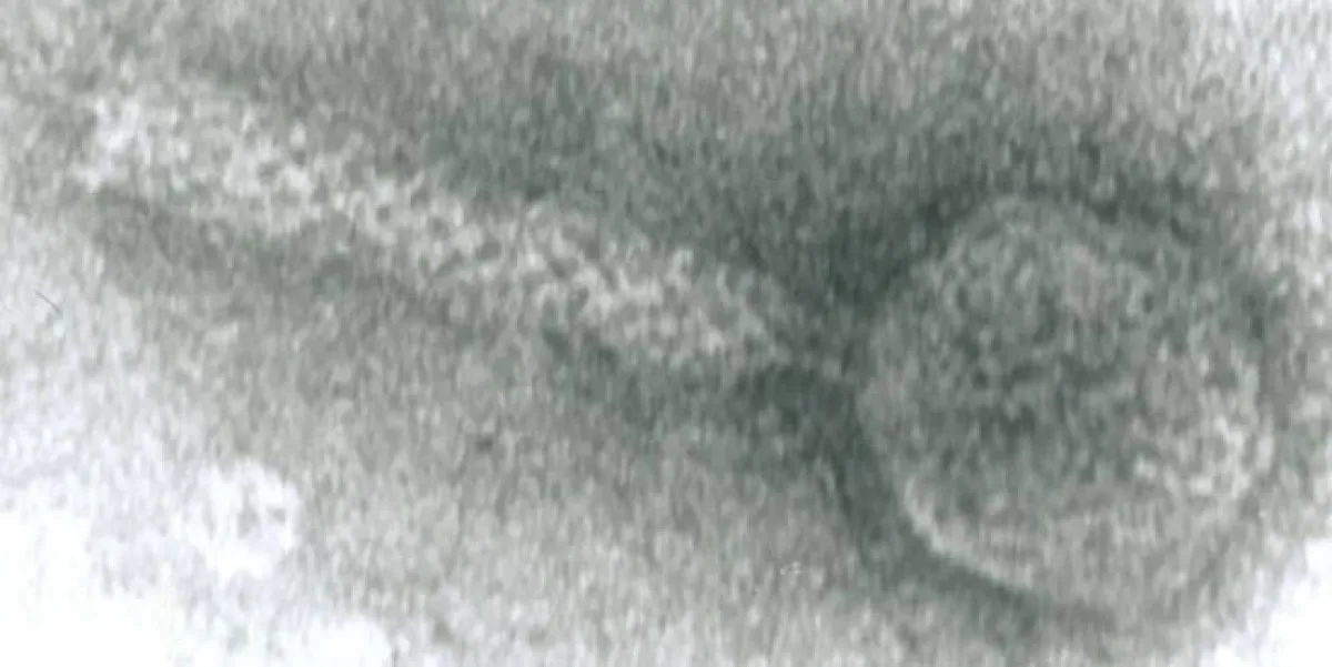 Microscopic image of a bacterium, possibly depicted in a phase-contrast microscopy style.