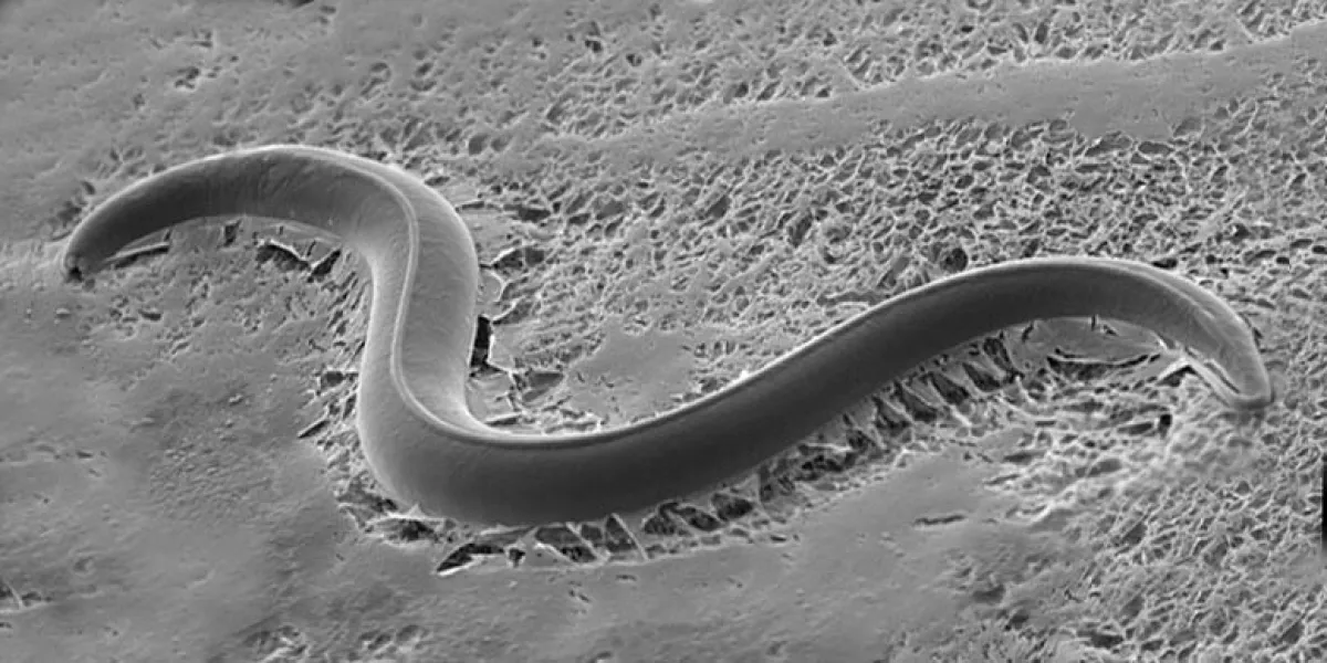 Electron microscope image of a nematode worm on a textured surface.