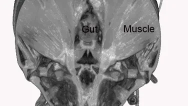 MRI scan of a human head with labels over specific areas indicating &quot;Gut&quot; and &quot;Muscle.&quot;