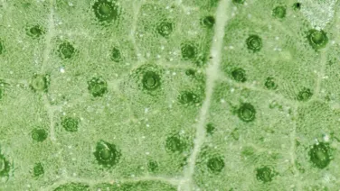 Close-up view of a leaf surface under the microscope, showing green cells and stomata.