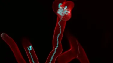 Fluorescent microscopy image showing a red-stained filamentous structure with a detailed blue-highlighted component at the top, all set against a dark background.