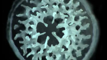 A close-up view of a complex, lace-like structure inside a circular frame, resembling a microscopic coral or sponge.