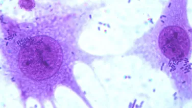 Microscopic view of cells with prominent nuclei, showing detailed internal structures.